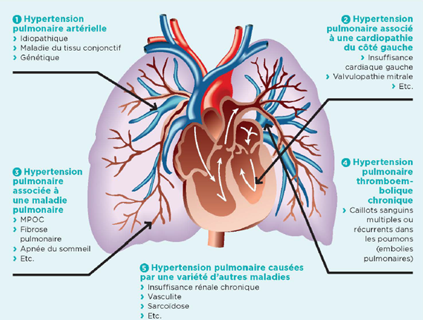 cover-hypertension.png cover-hypertension.png